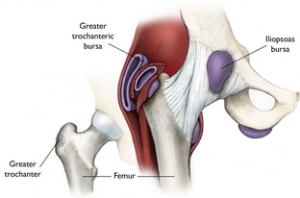 stretching for relief of trochanteric bursitis