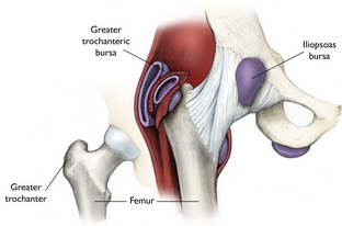 stretching for relief of trochanteric bursitis